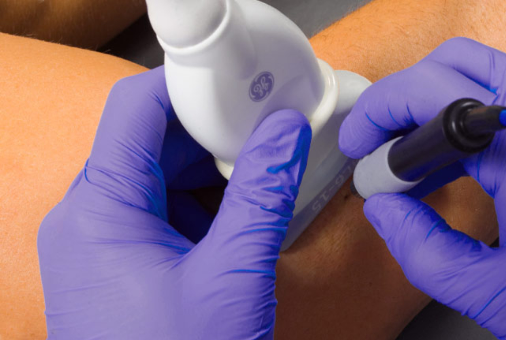 Curso de Electrólisis Percutánea Musculoesquelética Ecoguiada